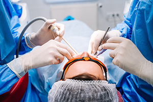 Oral Surgery